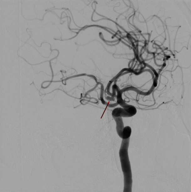 image.png W020210111380184468054.png