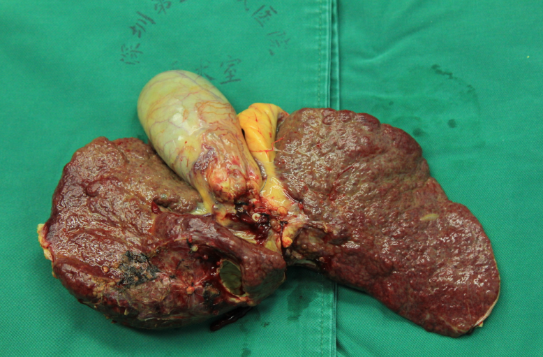 3.png W020210111395338861275.png