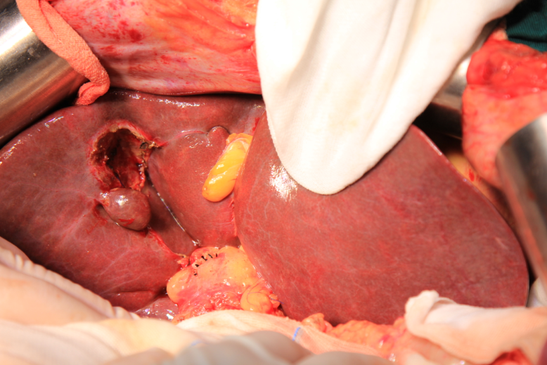 4.png W020210111395339040075.png